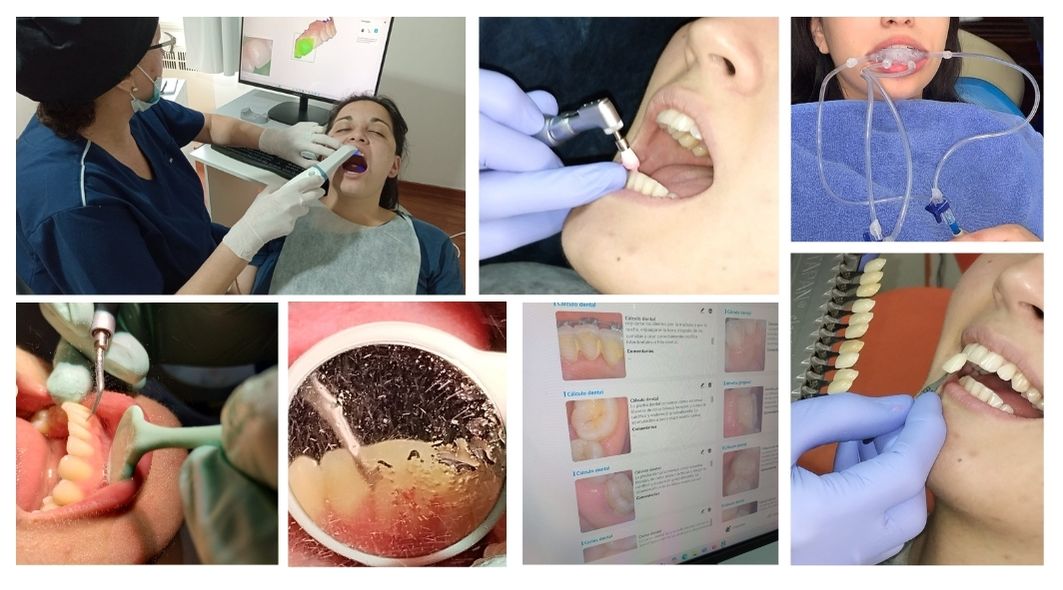 Higiene bucodental profecional